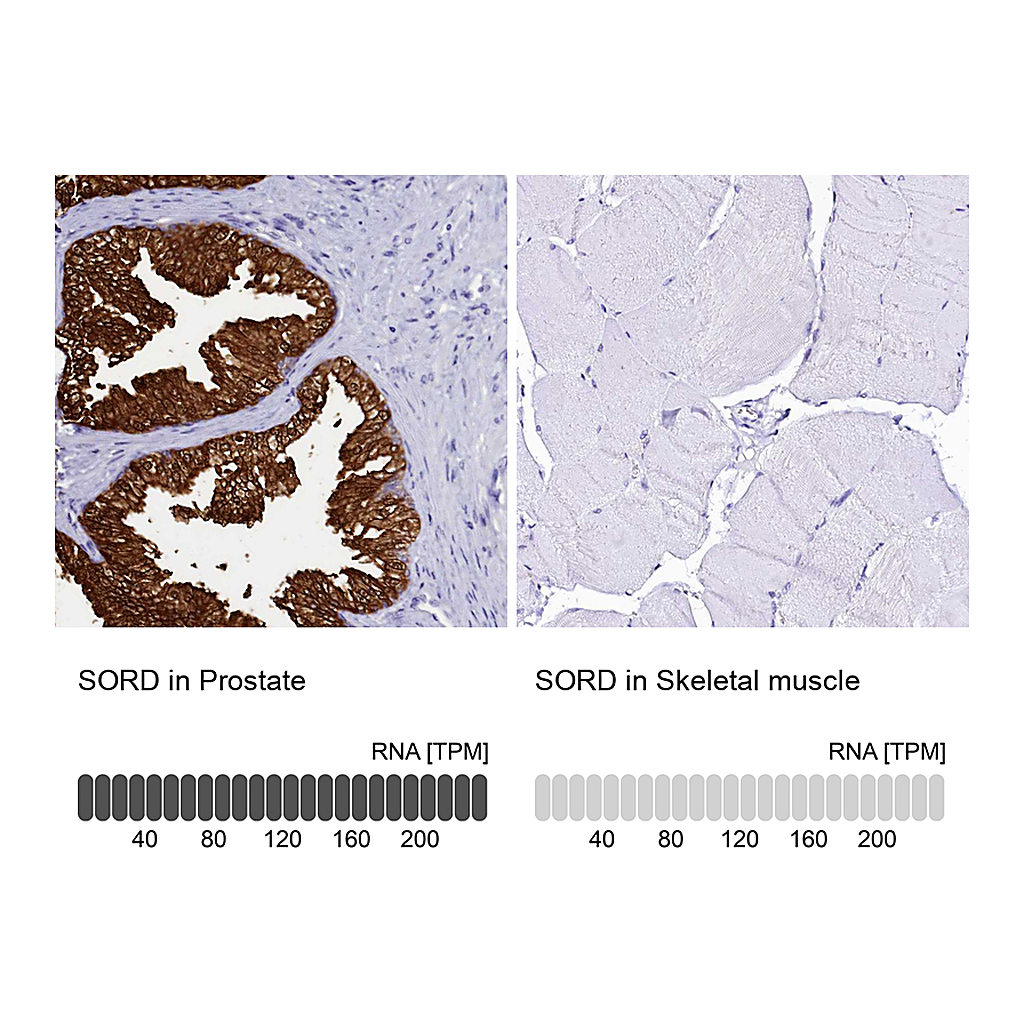 Atlas Antibodies Anti-SORD Antibody