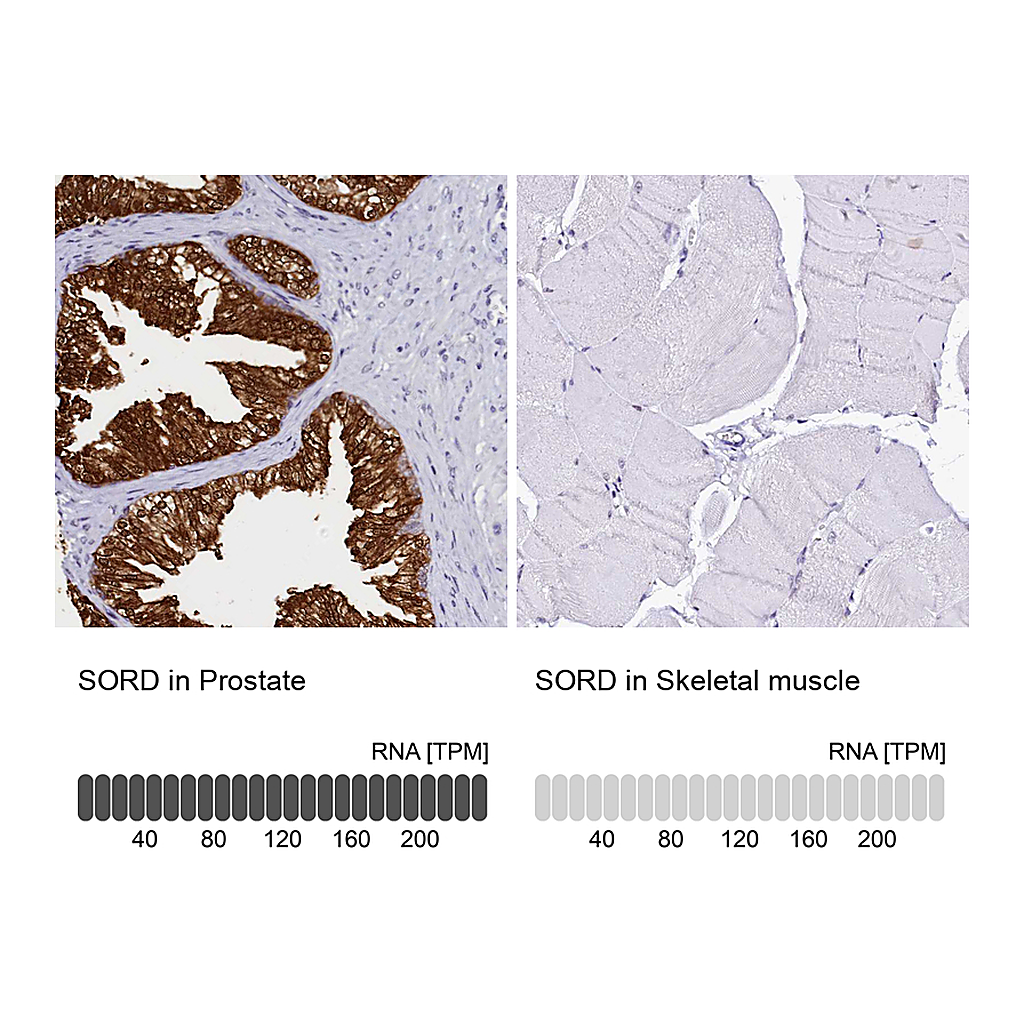 Atlas Antibodies Anti-SORD Antibody