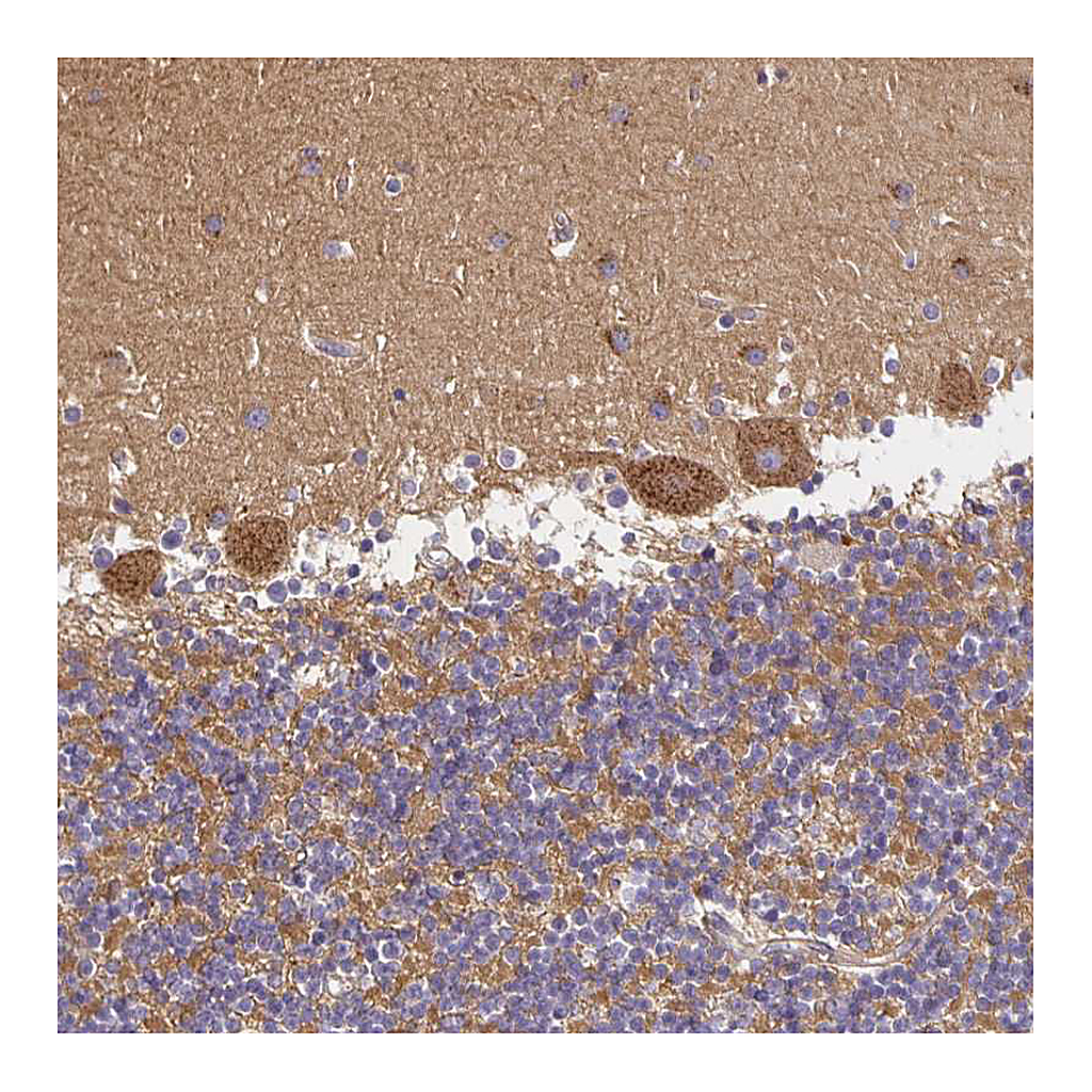 Atlas Antibodies Anti-SORL1 Antibody