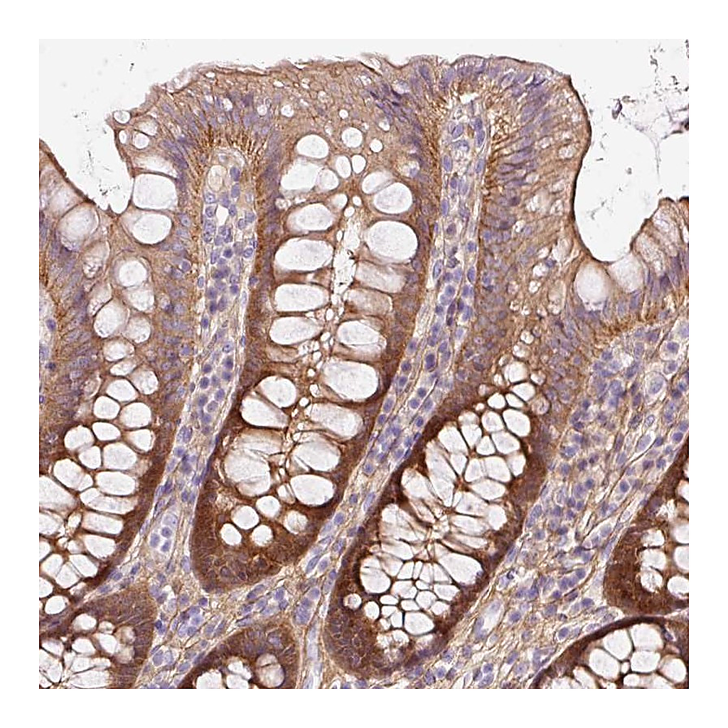 Atlas Antibodies Anti-SOS2 Antibody