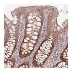 Atlas Antibodies Anti-SOS2 Antibody