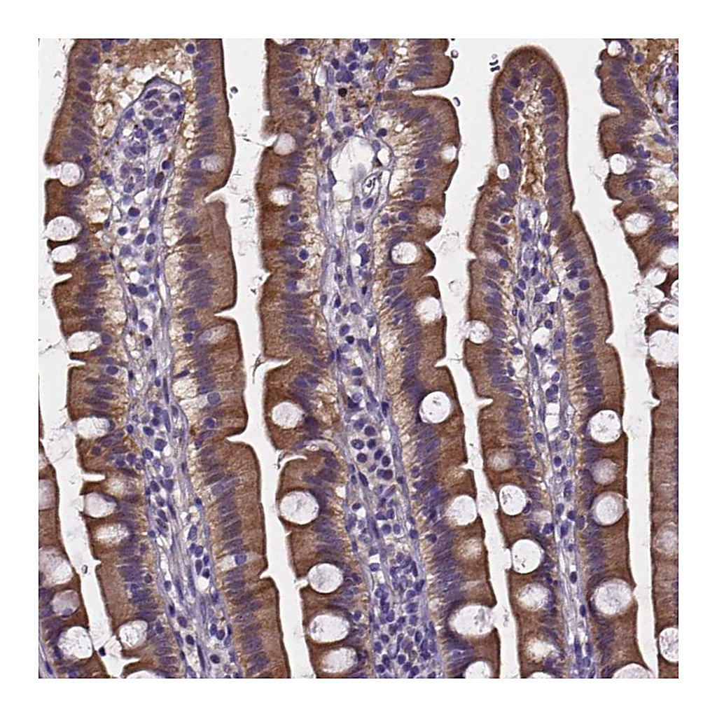 Atlas Antibodies Anti-SOWAHA Antibody