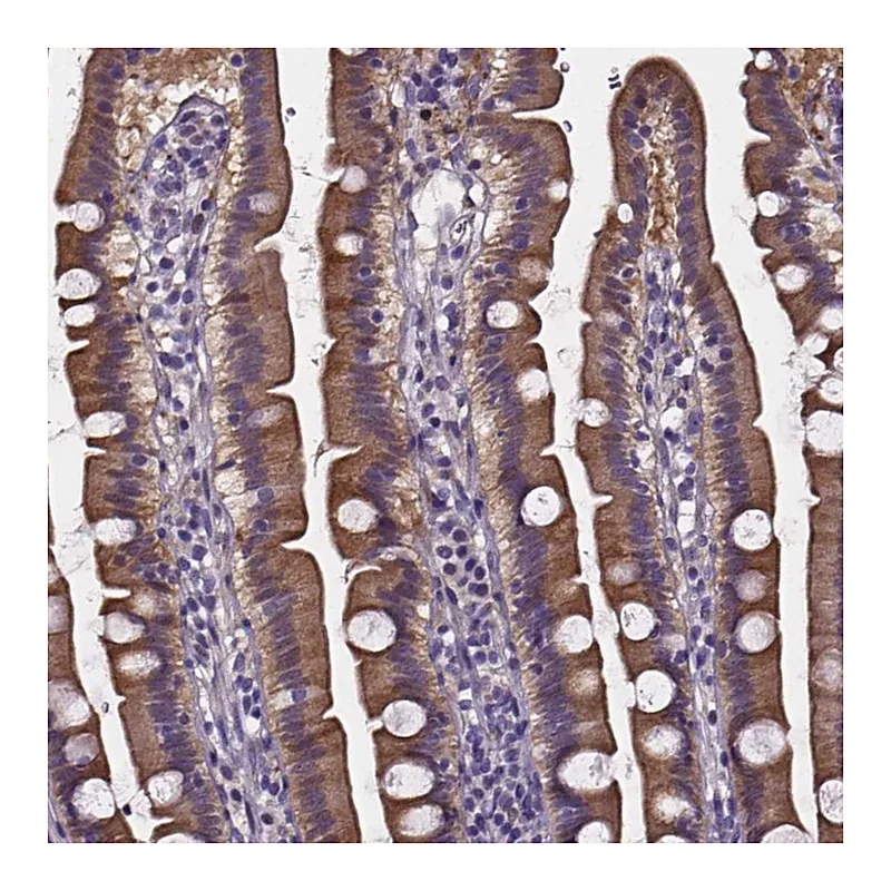 Atlas Antibodies Anti-SOWAHA Antibody