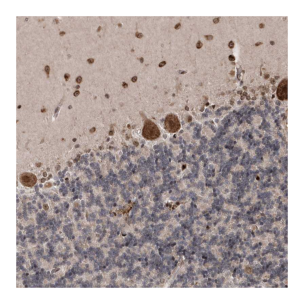 Atlas Antibodies Anti-SOWAHB Antibody