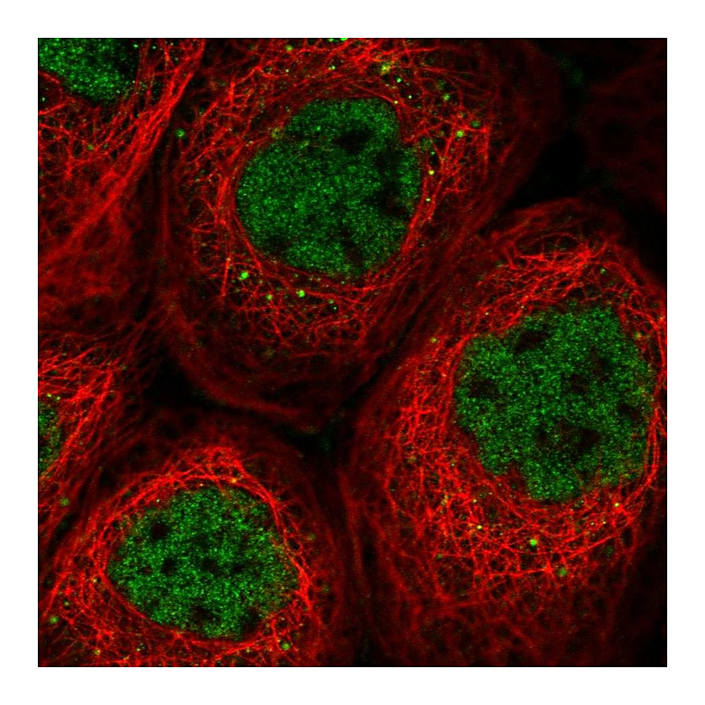 Atlas Antibodies Anti-SOS2 Antibody