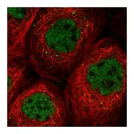 Atlas Antibodies Anti-SOS2 Antibody