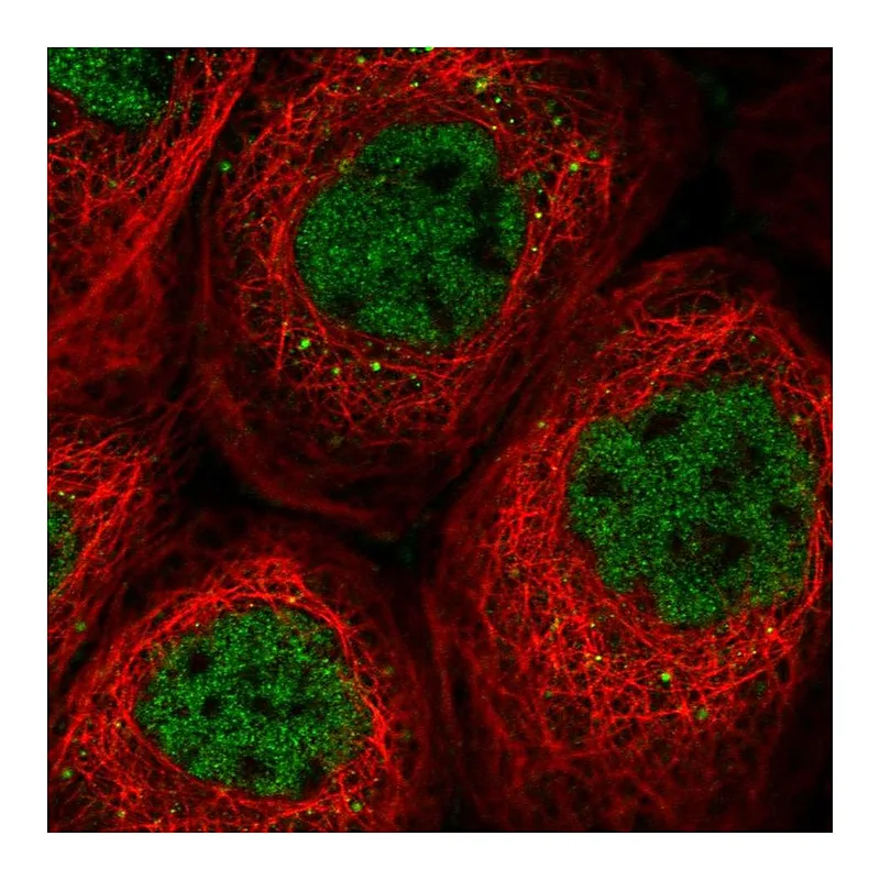 Atlas Antibodies Anti-SOS2 Antibody