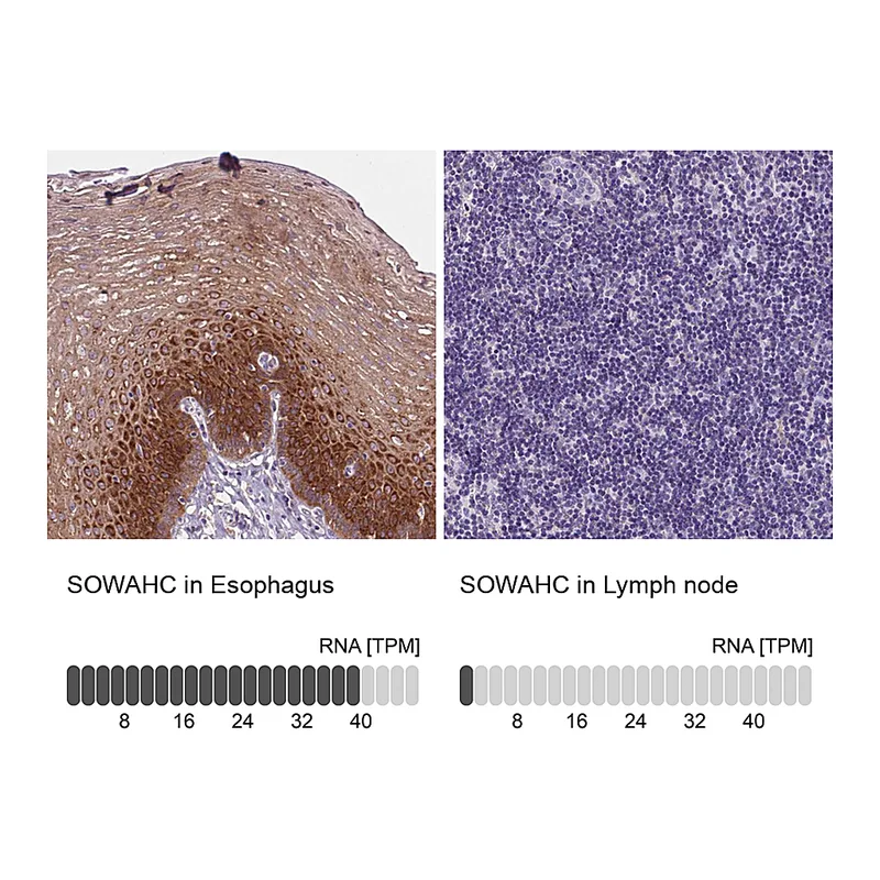 Atlas Antibodies Anti-SOWAHC Antibody