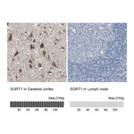 Atlas Antibodies Anti-SORT1 Antibody
