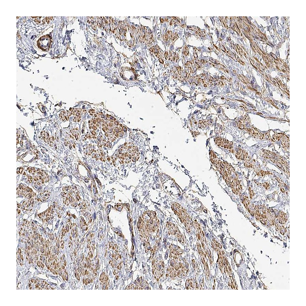 Atlas Antibodies Anti-SOWAHD Antibody