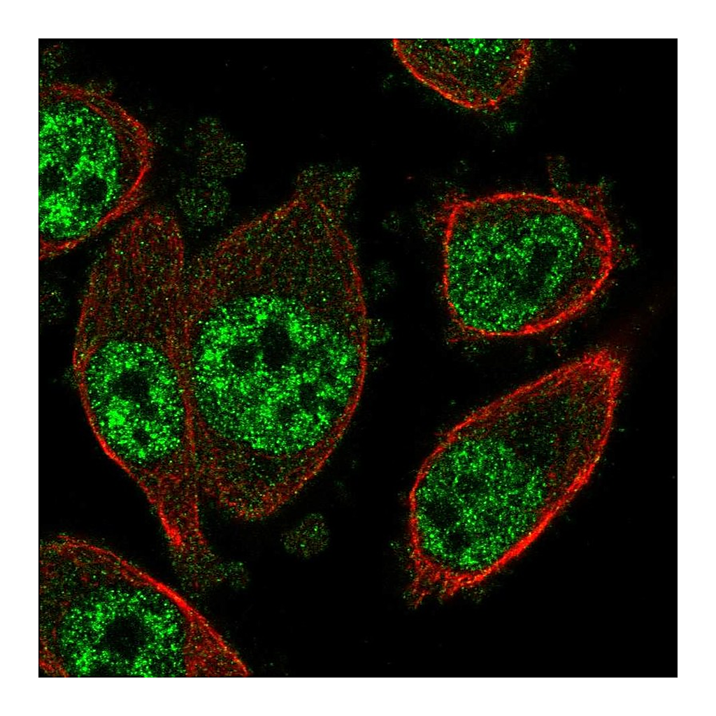 Atlas Antibodies Anti-SOX12 Antibody