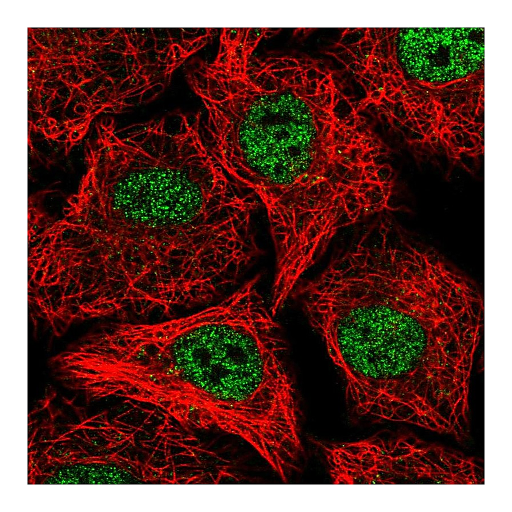 Atlas Antibodies Anti-SOX12 Antibody
