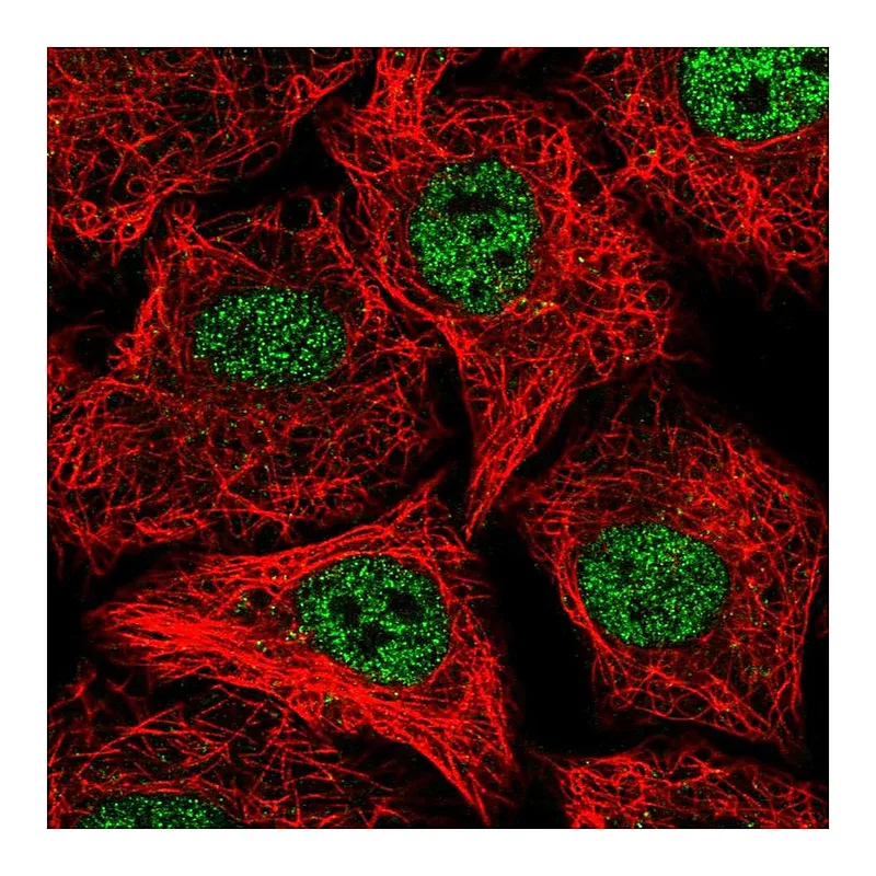 Atlas Antibodies Anti-SOX12 Antibody