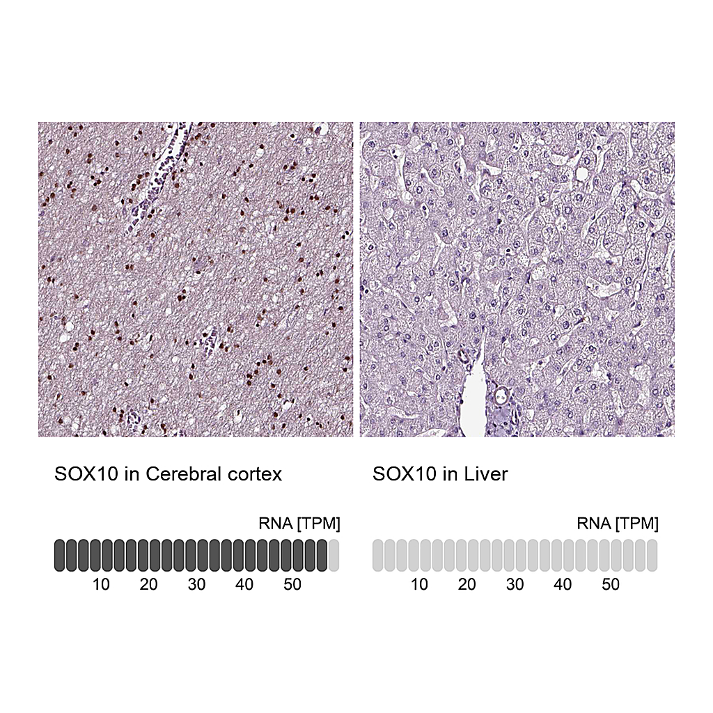 Atlas Antibodies Anti-SOX10 Antibody