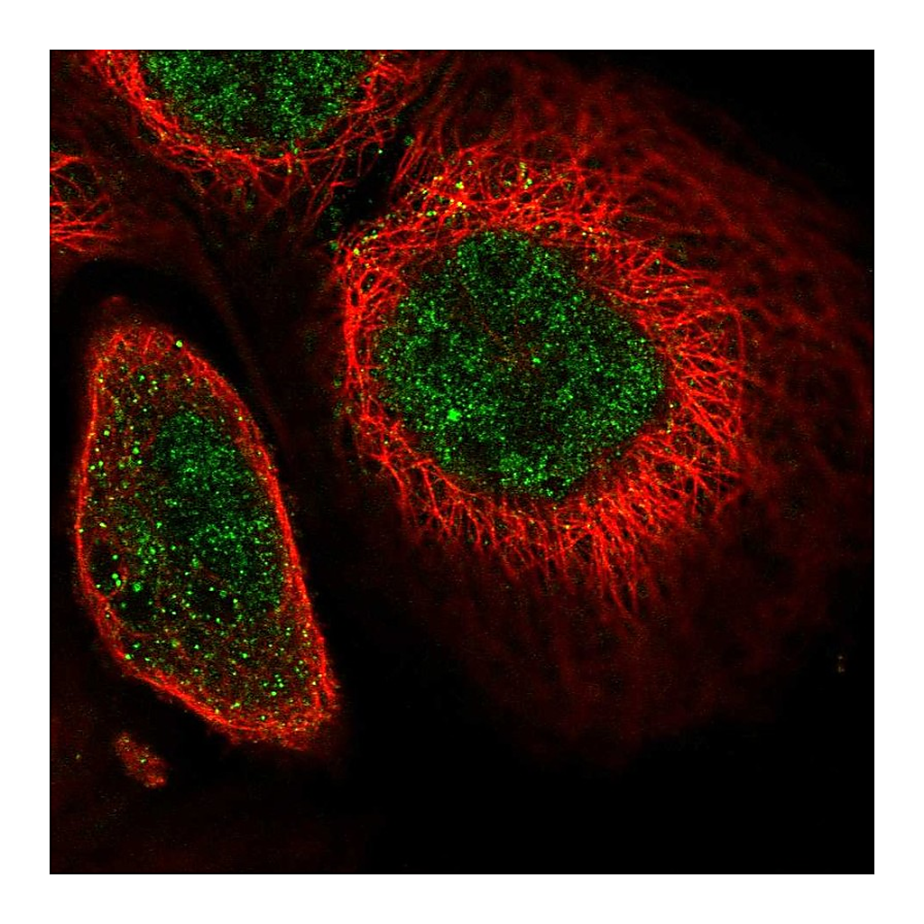 Atlas Antibodies Anti-SOX13 Antibody