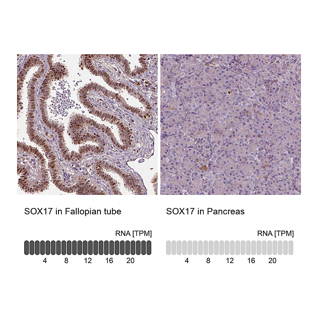 Atlas Antibodies Anti-SOX17 Antibody