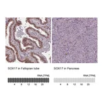 Atlas Antibodies Anti-SOX17 Antibody
