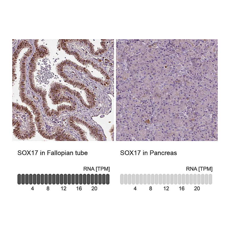 Atlas Antibodies Anti-SOX17 Antibody