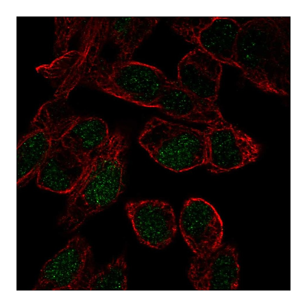 Atlas Antibodies Anti-SOX18 Antibody