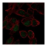 Atlas Antibodies Anti-SOX18 Antibody