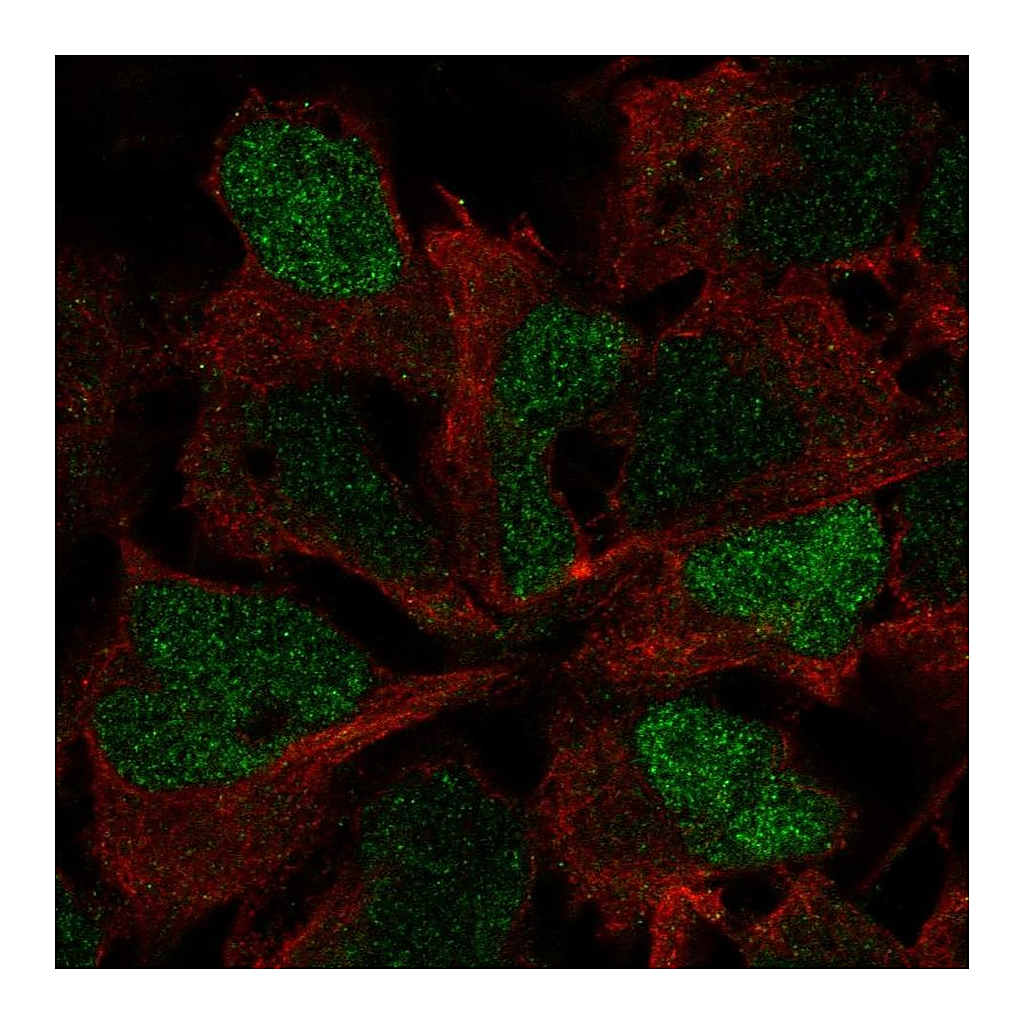 Atlas Antibodies Anti-SOX3 Antibody