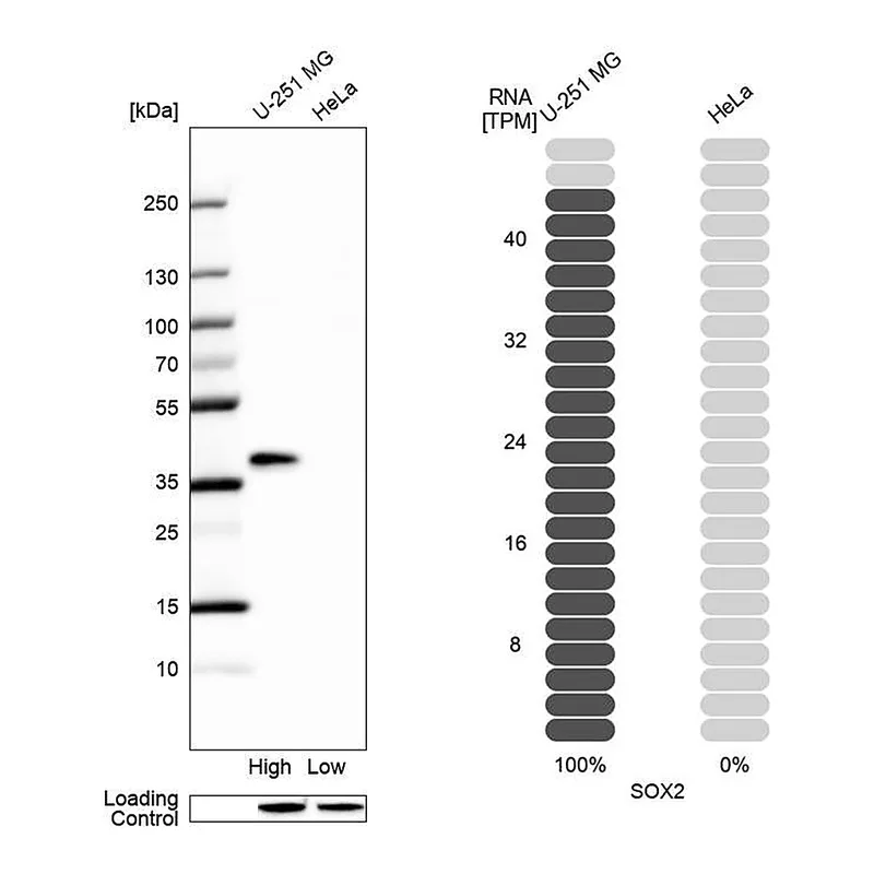 Atlas Antibodies Anti-SOX2 Antibody
