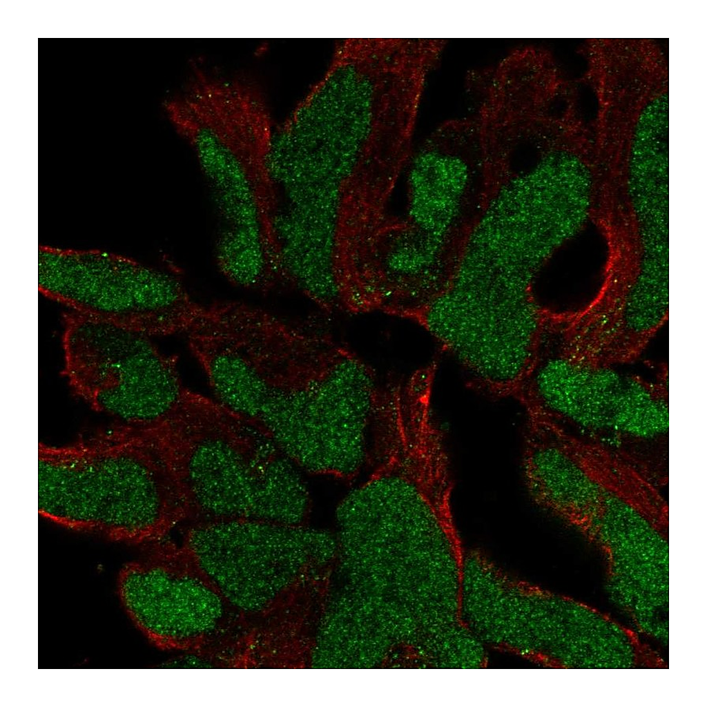 Atlas Antibodies Anti-SOX21 Antibody