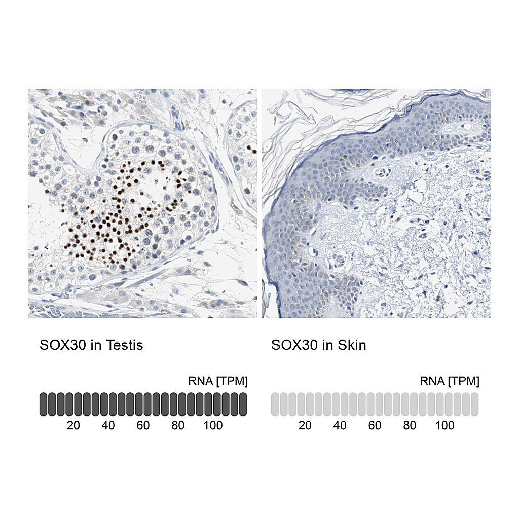 Atlas Antibodies Anti-SOX30 Antibody