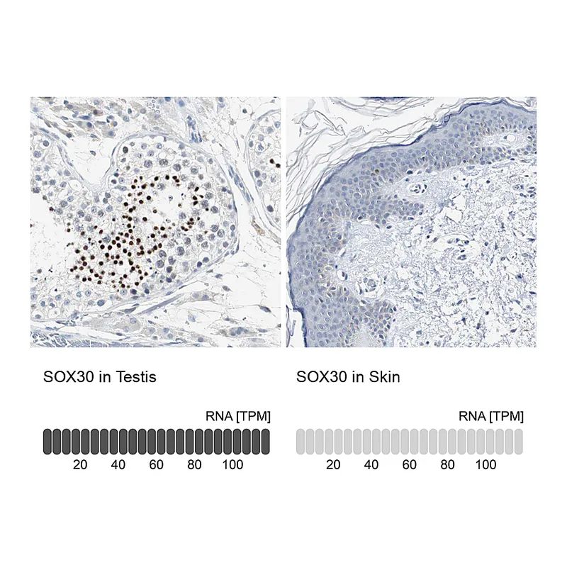 Atlas Antibodies Anti-SOX30 Antibody