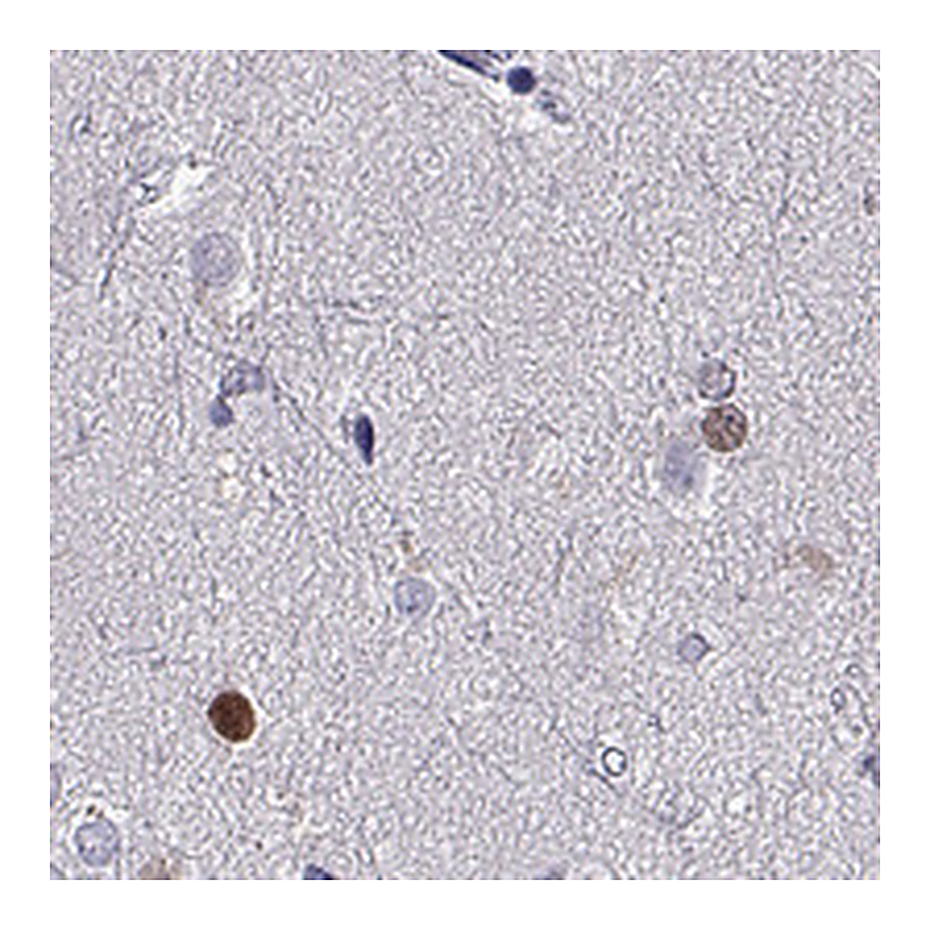 Atlas Antibodies Anti-SOX21 Antibody