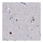 Atlas Antibodies Anti-SOX21 Antibody