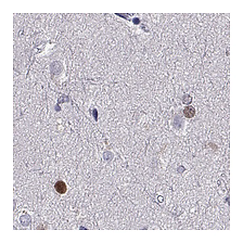 Atlas Antibodies Anti-SOX21 Antibody