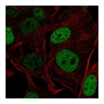 Atlas Antibodies Anti-SOX5 Antibody