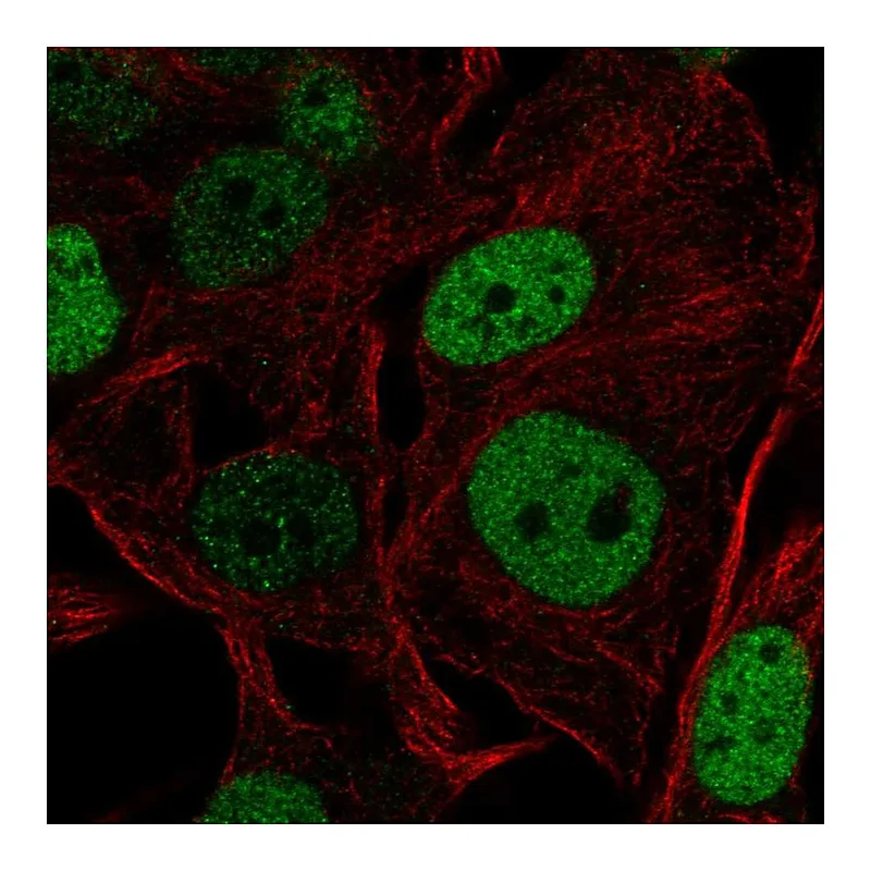 Atlas Antibodies Anti-SOX5 Antibody