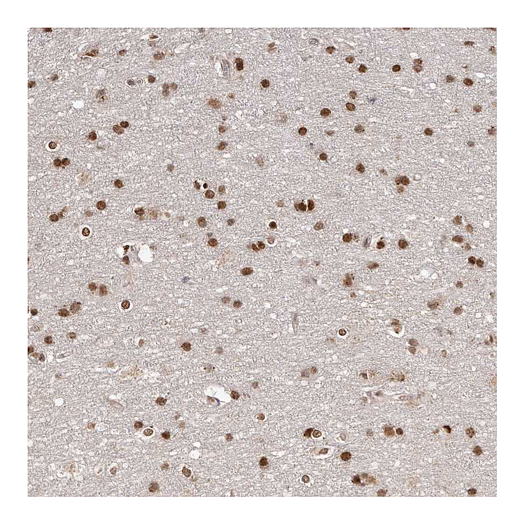 Atlas Antibodies Anti-SOX4 Antibody