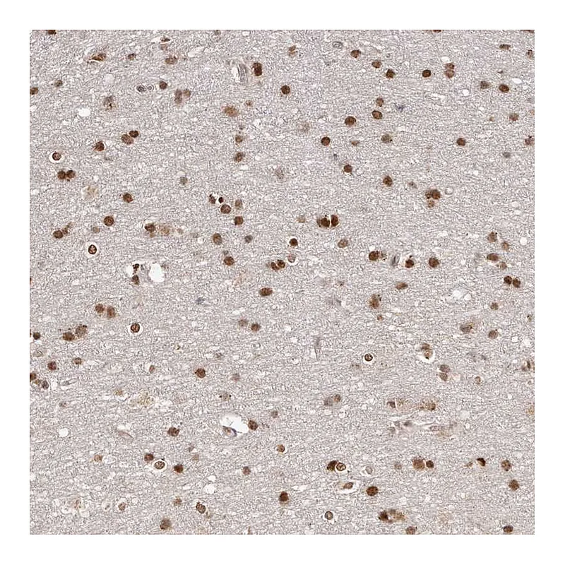 Atlas Antibodies Anti-SOX4 Antibody