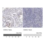 Atlas Antibodies Anti-SOX6 Antibody