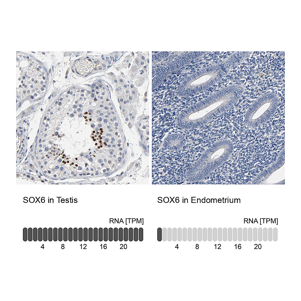 Atlas Antibodies Anti-SOX6 Antibody