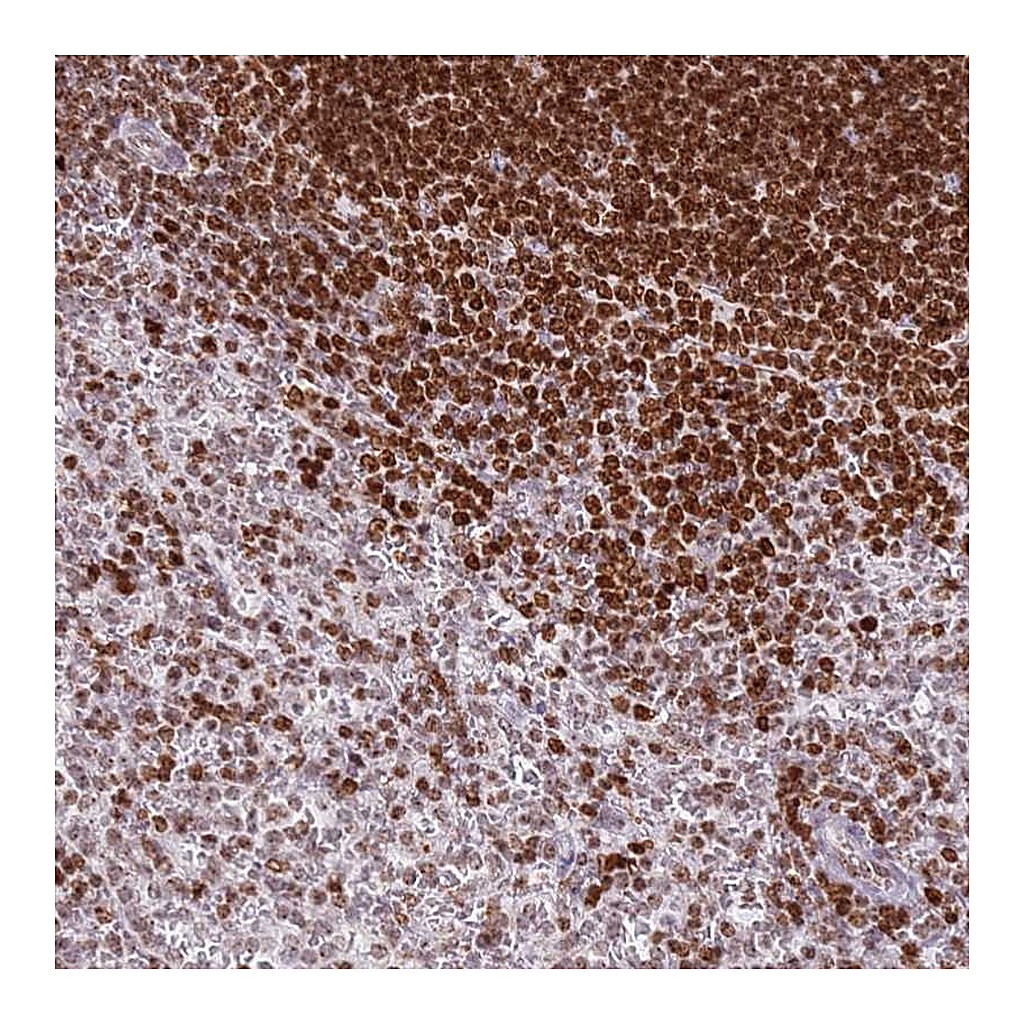 Atlas Antibodies Anti-SP110 Antibody
