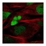 Atlas Antibodies Anti-SOX8 Antibody