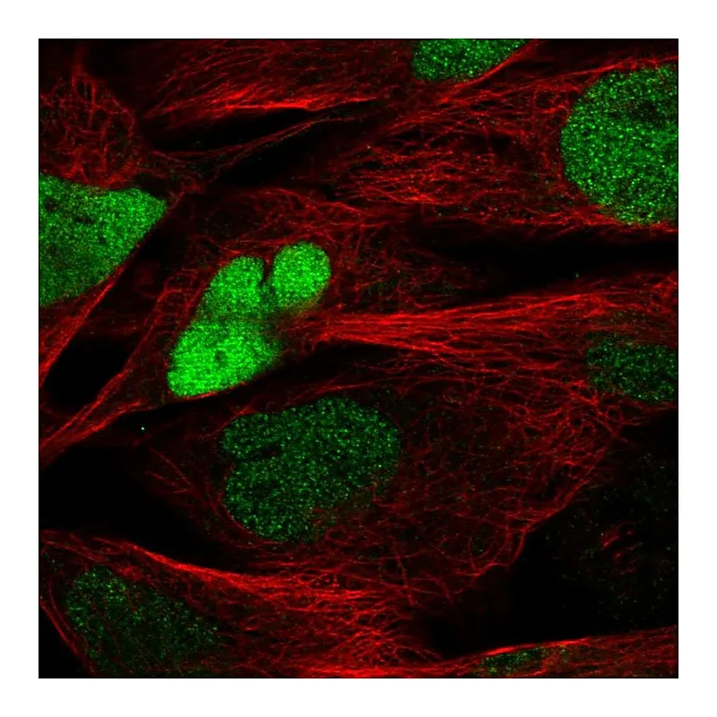 Atlas Antibodies Anti-SOX8 Antibody