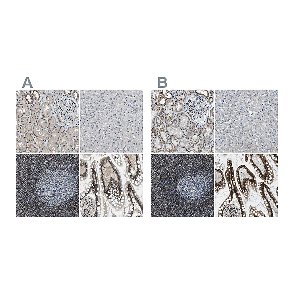 Atlas Antibodies Anti-SP100 Antibody