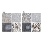 Atlas Antibodies Anti-SP100 Antibody