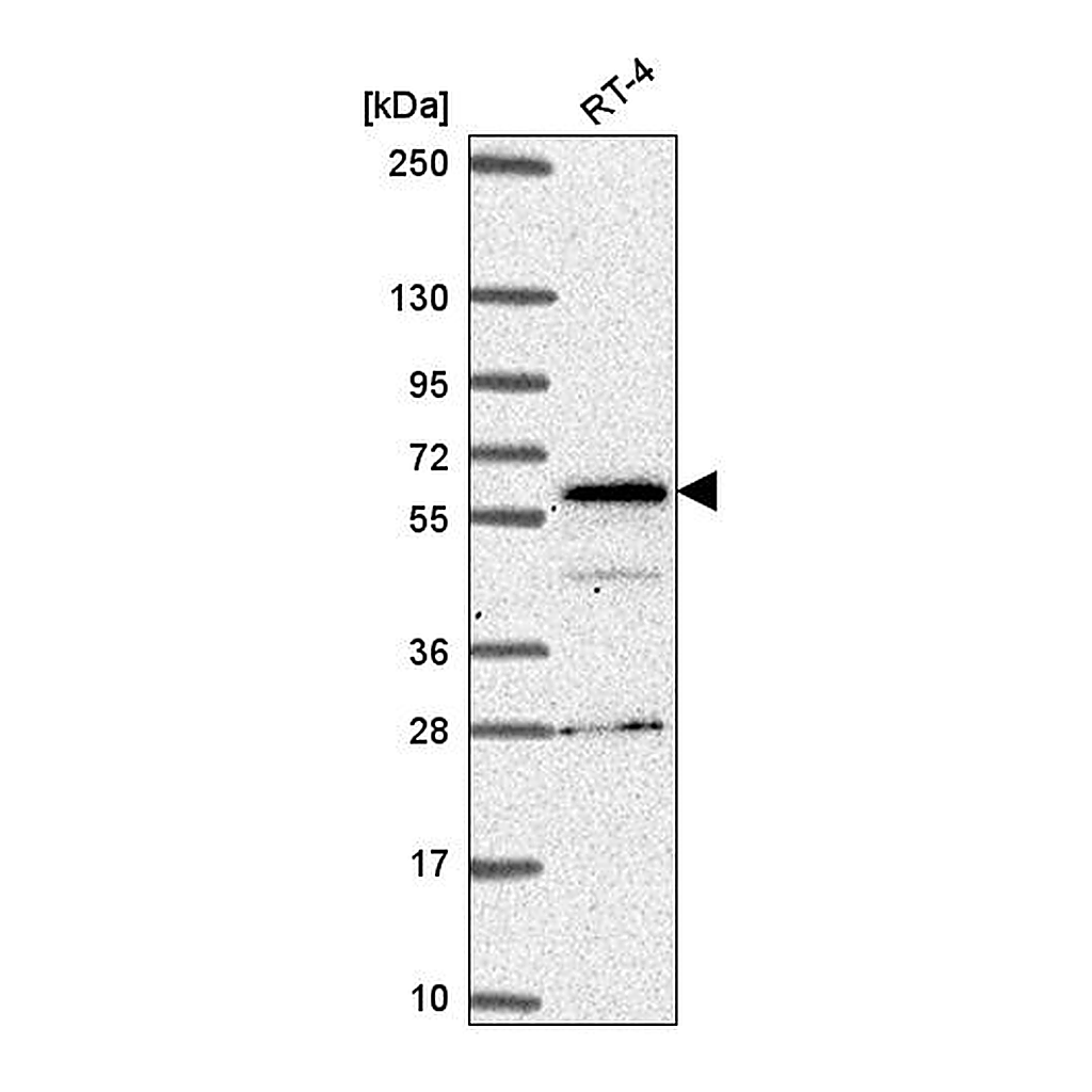 Atlas Antibodies Anti-SP110 Antibody