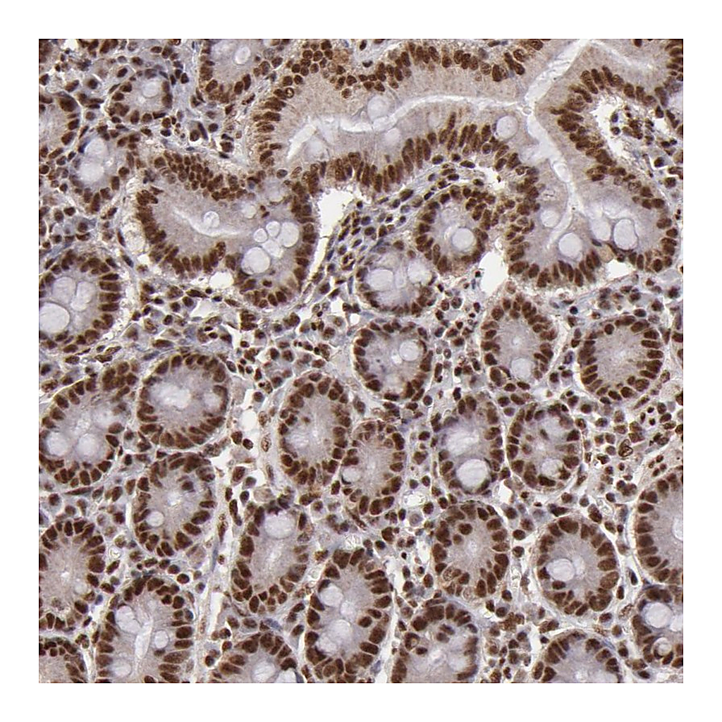 Atlas Antibodies Anti-SP1 Antibody