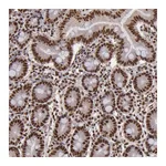 Atlas Antibodies Anti-SP1 Antibody