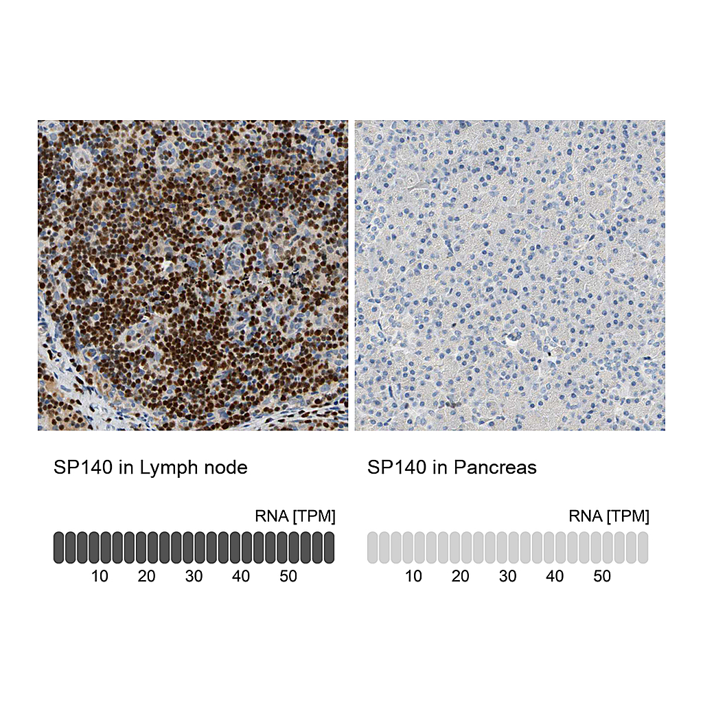Atlas Antibodies Anti-SP140 Antibody