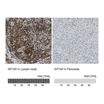 Atlas Antibodies Anti-SP140 Antibody