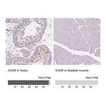 Atlas Antibodies Anti-SOX9 Antibody