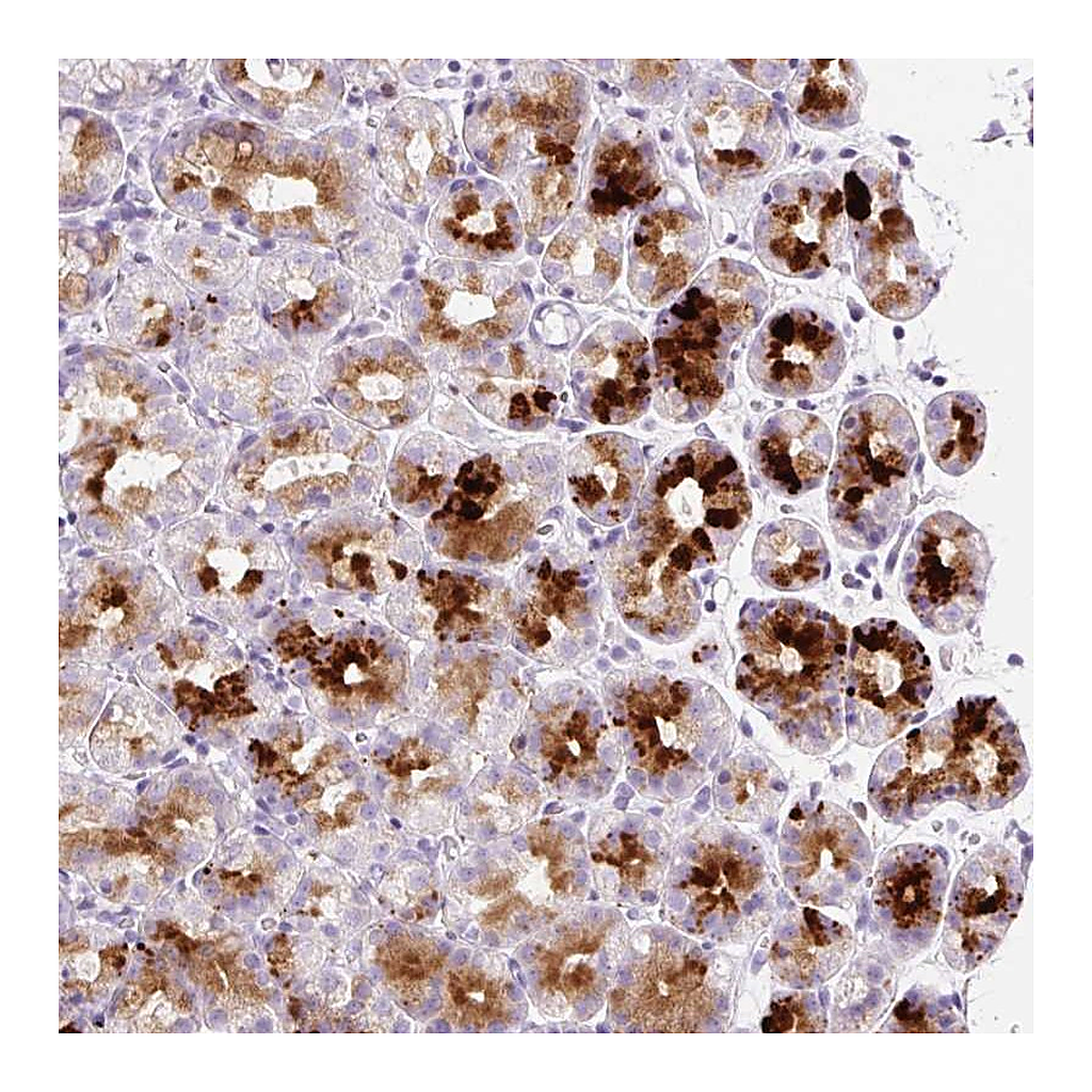 Atlas Antibodies Anti-SP140L Antibody
